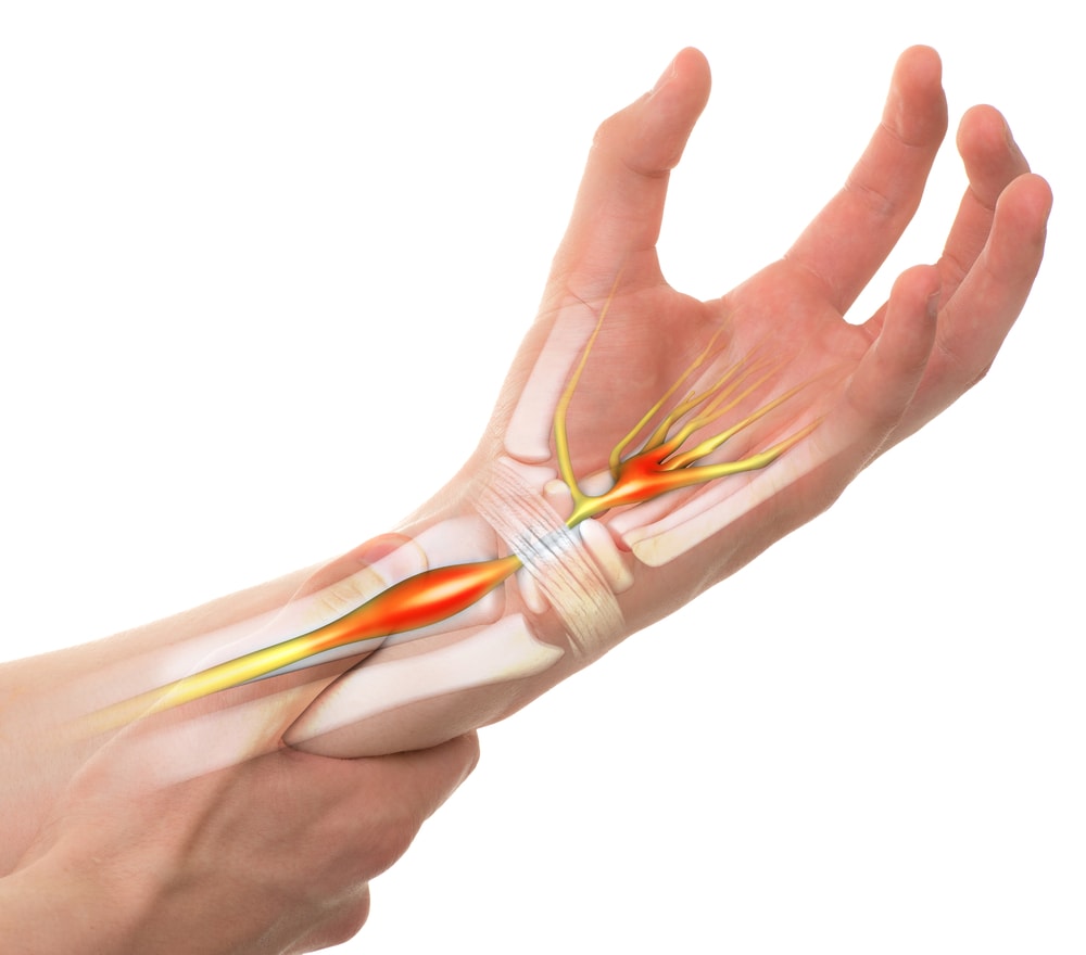How Long Does Tendonitis Take to Go Away Wrist